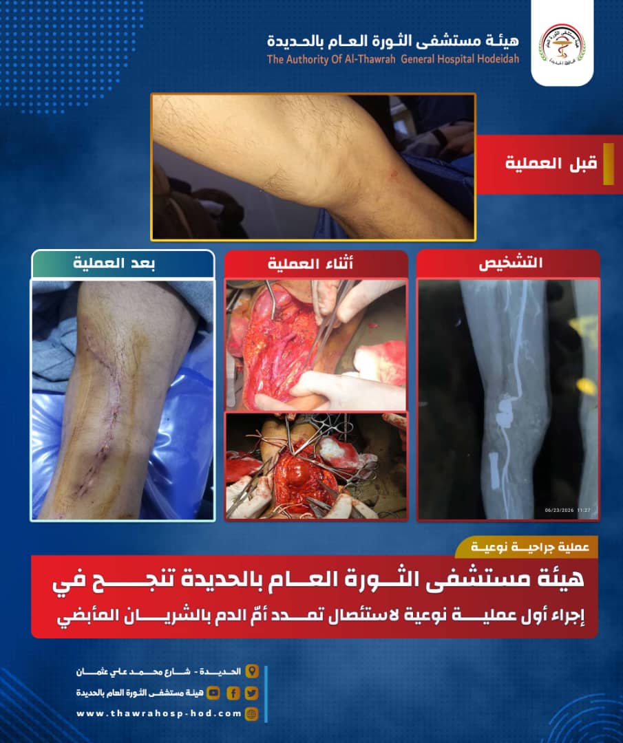 هيئة مستشفى الثورة العام بالحديدة تنجح في إجراء أول عملية نوعية لاستئصال تمدد أمّ الدم بالشريان المأبضي